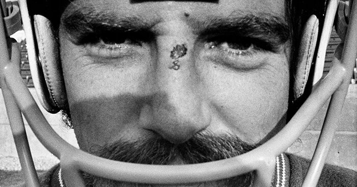 Steve Kiner, Linebacker Who Was Open About Drug Use, Is Dead at 77
