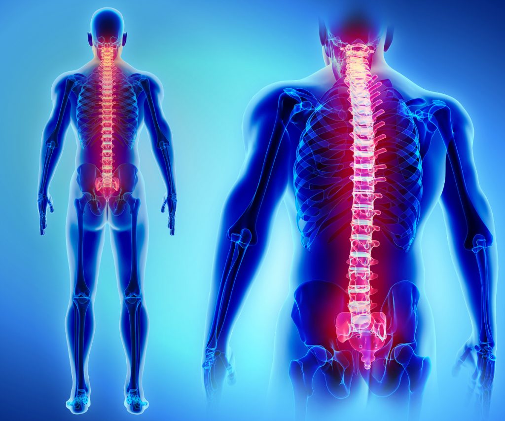 How a Paralysis Injury Attorney Can Help You Pursue Long-Term Compensation How a Paralysis Injury Attorney Can Help You Pursue Long-Term Compensation