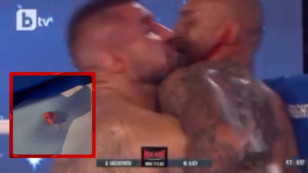 Georgi Valentinov bites off part of opponent’s ear