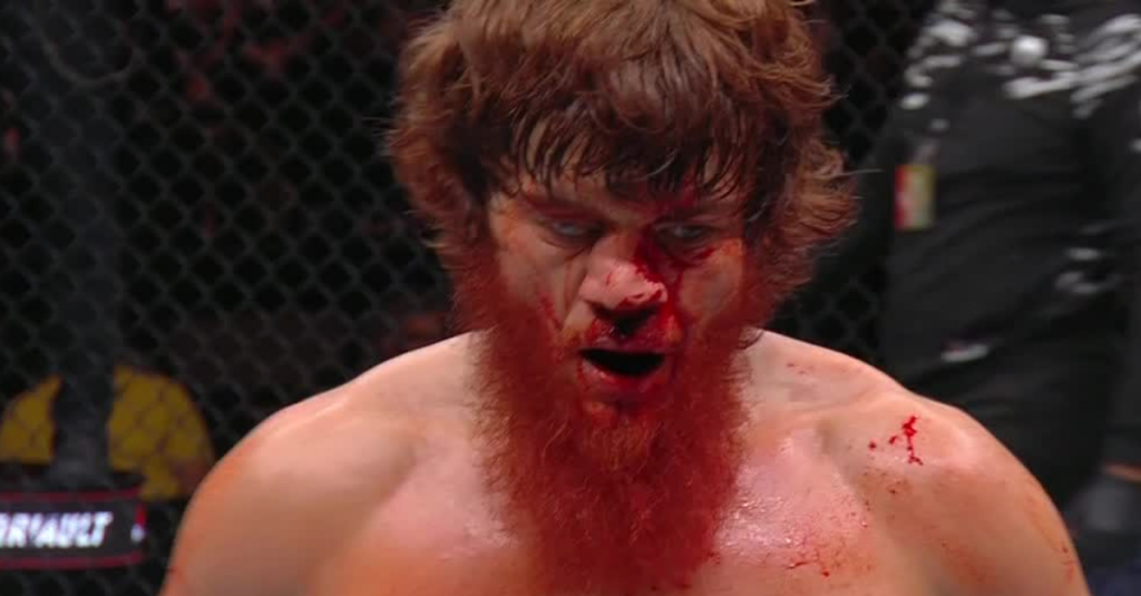 Shara Bullet Hospitalized in Abu Dhabi for Nose Surgery Following UFC Bout