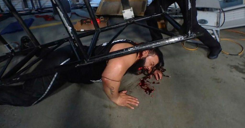 Jacob Fatu Loses Teeth And Blood Due To Attack On WWE SmackDown Jacob Fatu Loses Teeth And Blood Due To Attack On WWE SmackDown