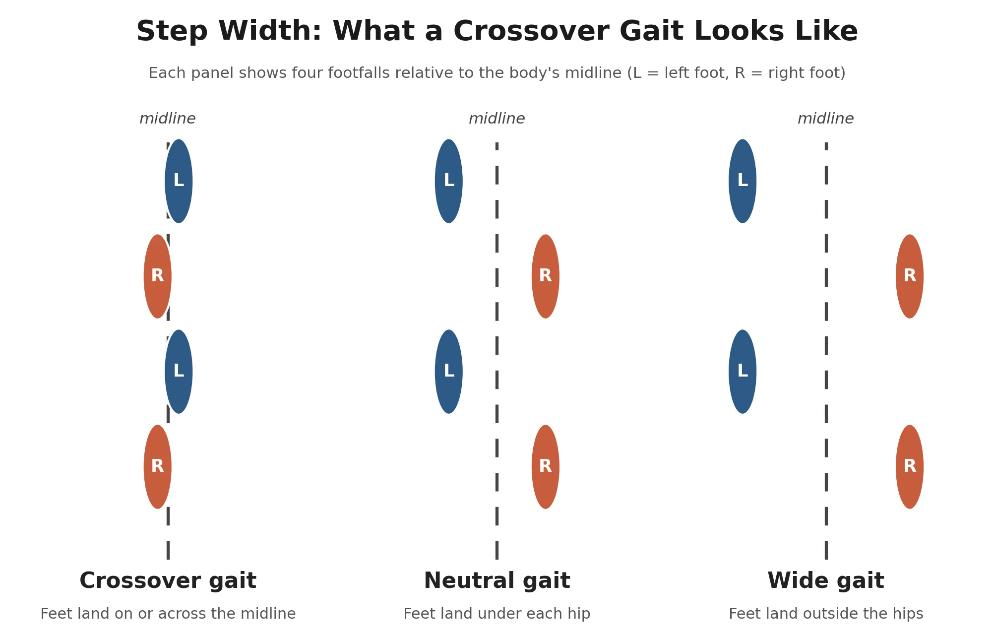 Crossover Gait: How to Fix It and Ease IT Band Pain Crossover Gait: How to Fix It and Ease IT Band Pain