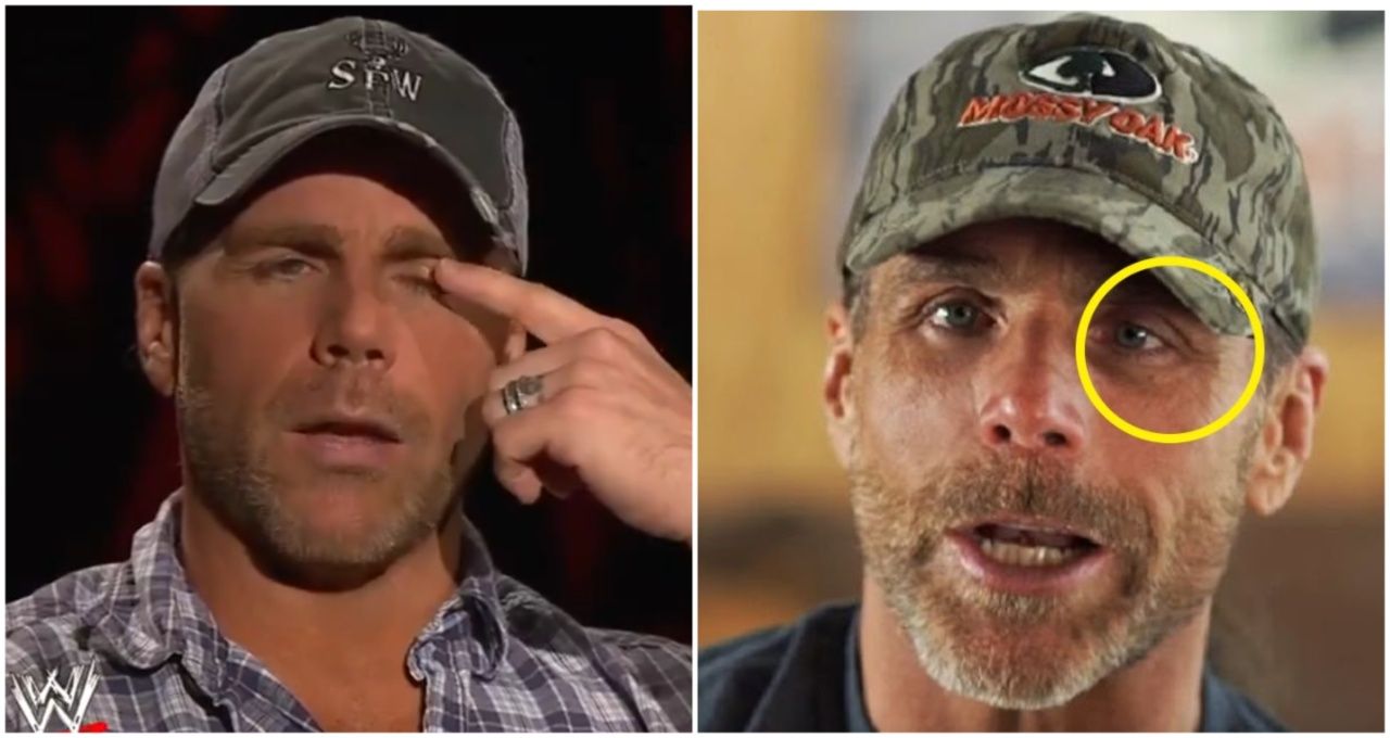 What Happened to Shawn Michaels' Eye Explained