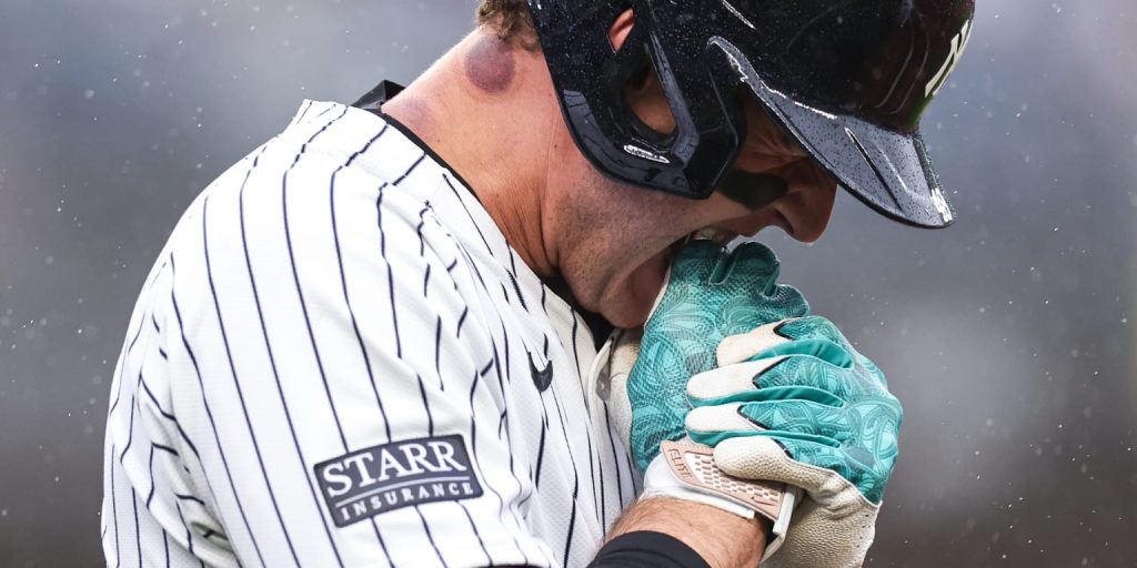 Rizzo fractures fingers on HBP, isn't ruled out for playoffs Rizzo fractures fingers on HBP, isn't ruled out for playoffs