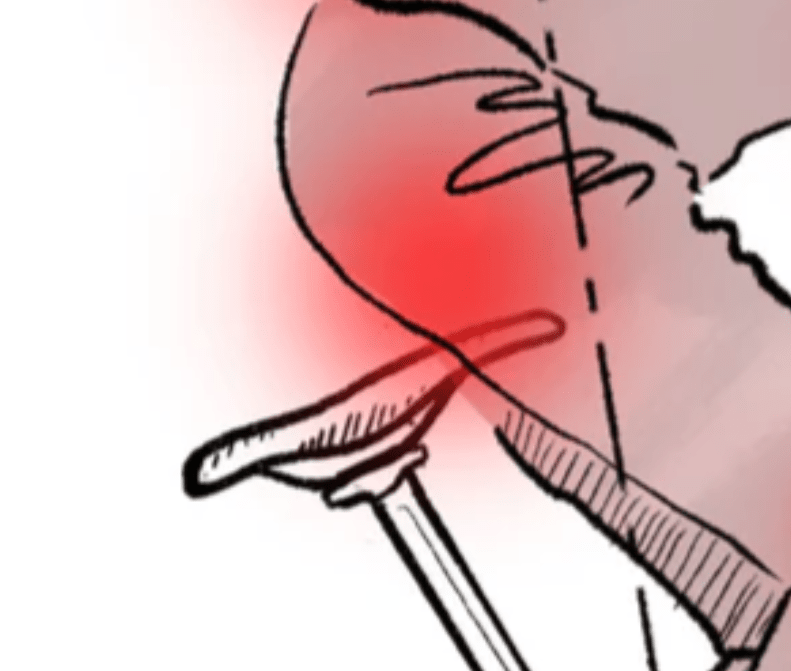 A Real Pain In The… A Real Pain In The…