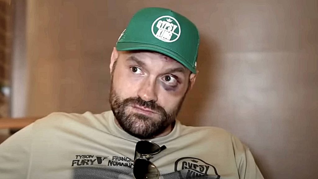 Tyson Fury protests 'robbery' after Oleksandr Usyk loss Tyson Fury protests 'robbery' after Oleksandr Usyk loss
