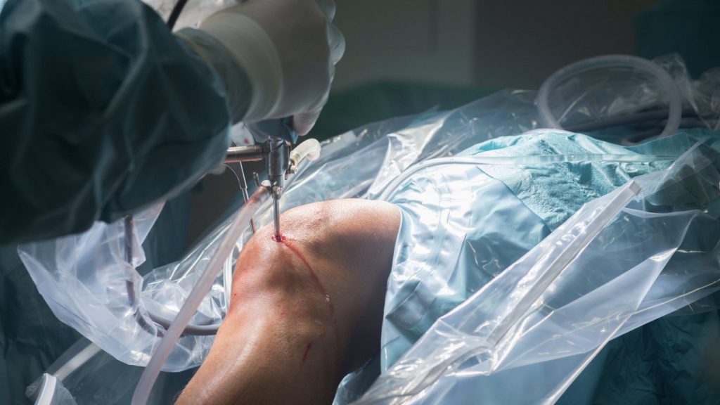 Common Mistakes to Avoid During Surgery Recovery Common Mistakes to Avoid During Surgery Recovery