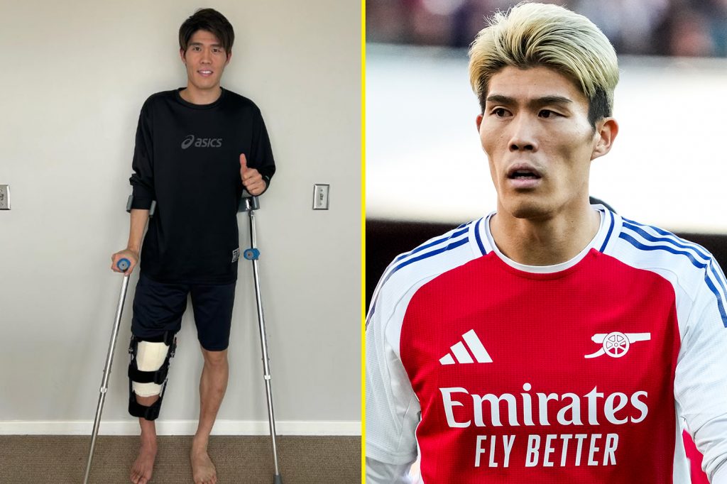 Forgotten Arsenal player reveals he’s undergone surgery after just six minutes of football this season Forgotten Arsenal player reveals he’s undergone surgery after just six minutes of football this season