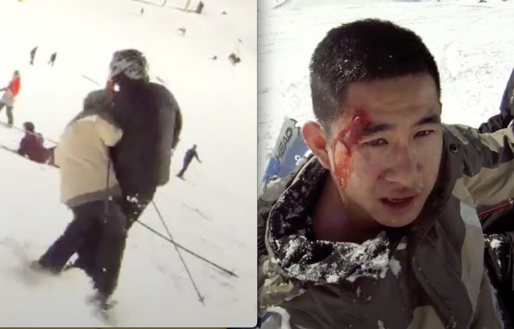 Out of Control Skier Bloodied After Causing Collision